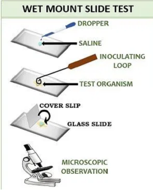 Wet Mount Motility Test - Introduction, Principle, Procedure, Result